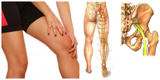 douleurs au dos et à la jambe de traitement