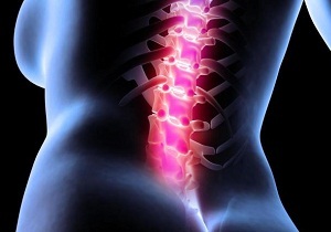 les causes de douleurs au dos